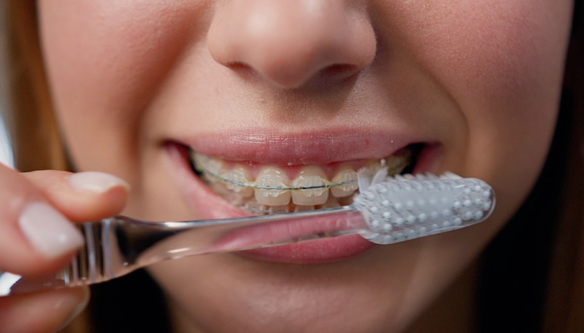 Niña lavándose los dientes con brackets (1).webp