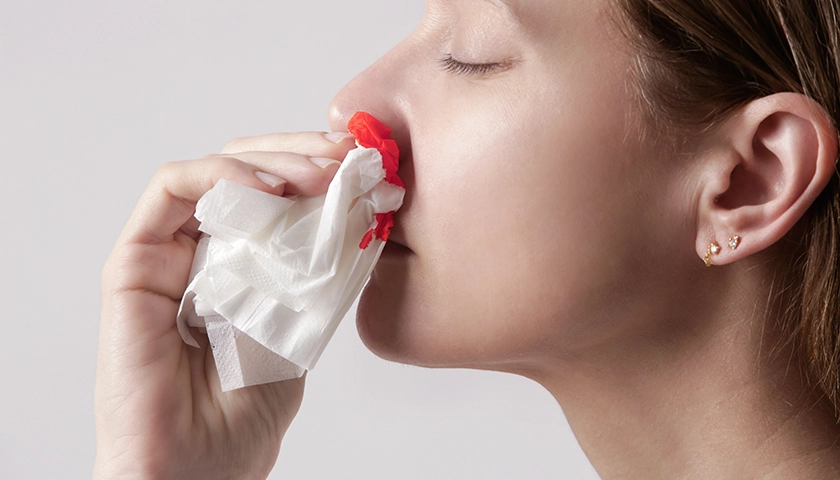 Persona inclinándose mientras se presiona la nariz con un pañuelo para cortar un sangrado nasal en verano..webp